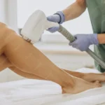 Küçükçekmece Lazer Epilasyon – FD631A (WebP)